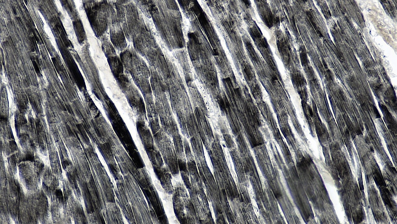 Lengthwise striated muscle profiles have broad dark transverse junctional bands at uneven intervals, unlike the regularly repeated finer striations.