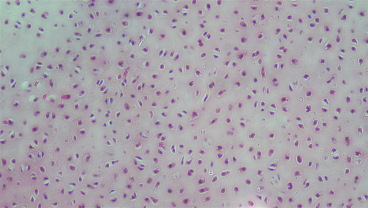 Numerous rounded purple cell profiles, some paired and some with pale rims, are separated by a broad, relatively uniform pale extracellular matrix.
