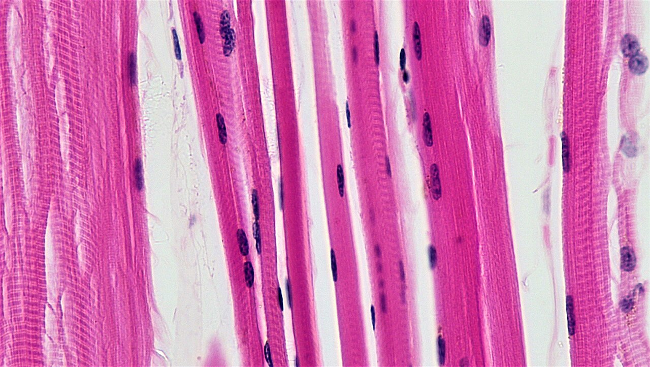 Long parallel pink muscle fibers display repeated transverse striations, with dark elongated nuclei near the margins of several fibers.