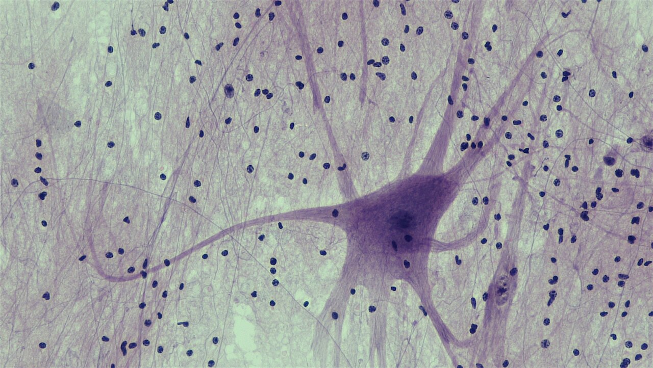 A large purple cell body with a central nuclear region extends several tapering processes among many smaller dark nuclear profiles and fine background strands.