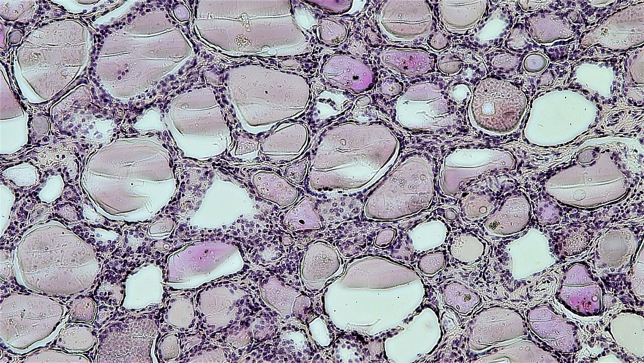 Rounded and oval follicles contain pale pink material and are bounded by darker epithelial nuclear rings; some luminal material has cracks and clear margins.